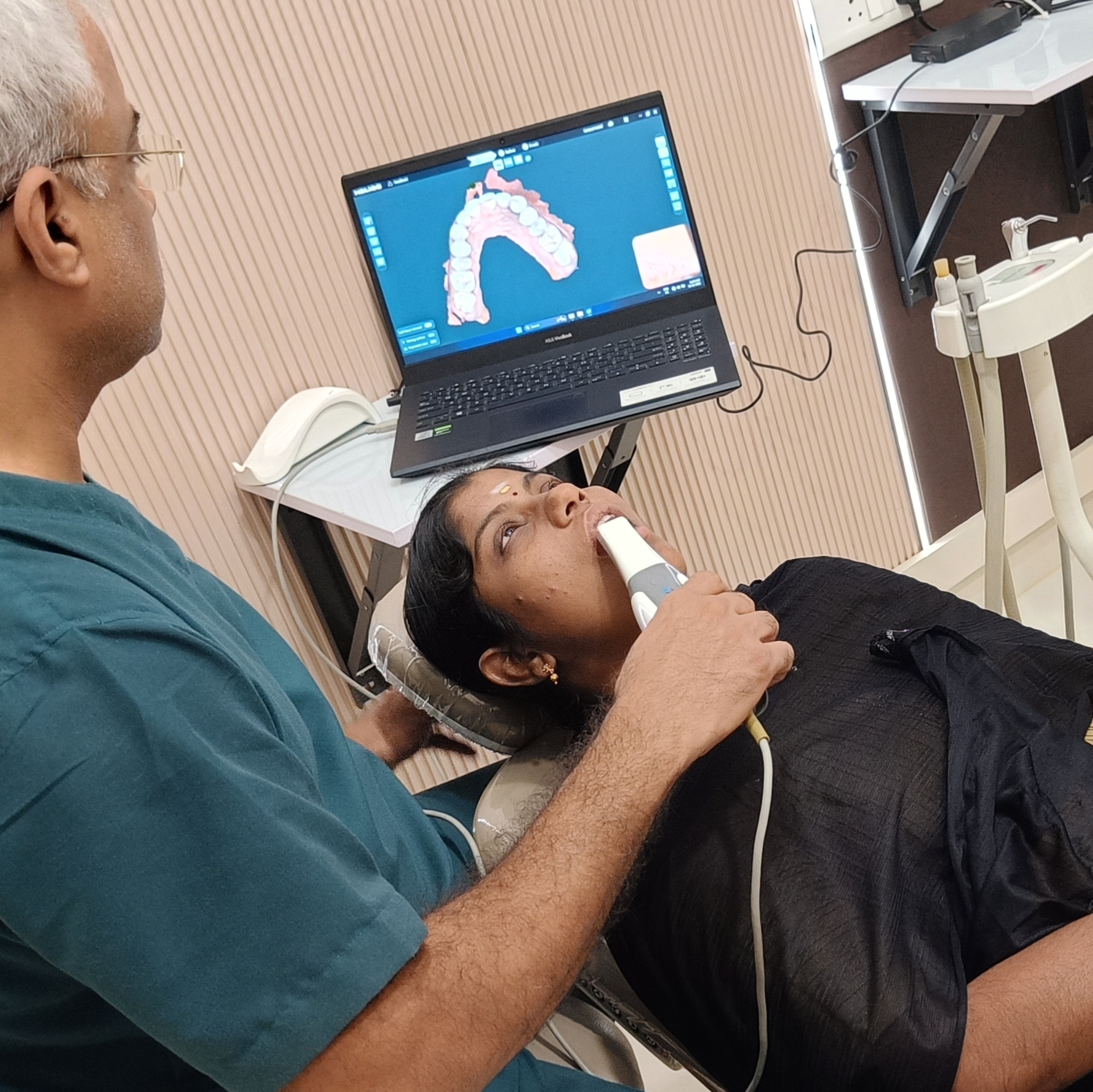 Intra-Oral Scanner